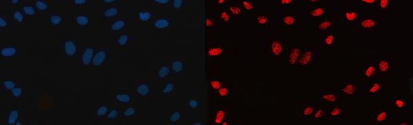 IF - Anti-CPSF6 Antibody Picoband™ (monoclonal, 3F11E1) ABO16592